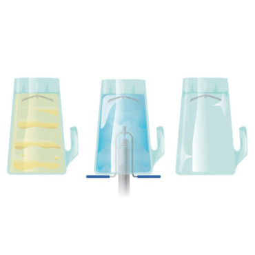 lavador jarra, ejemplos