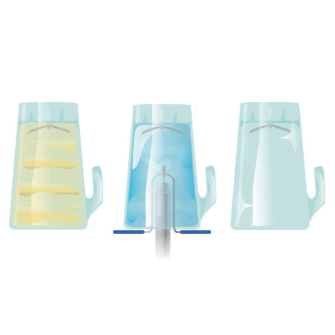 lavador jarra, ejemplos